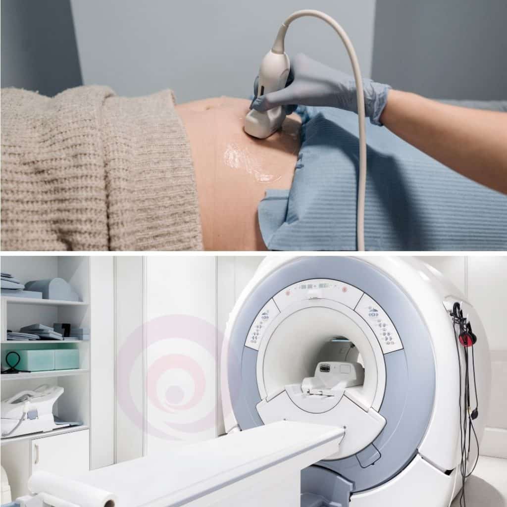 Ultrasound vs MRI