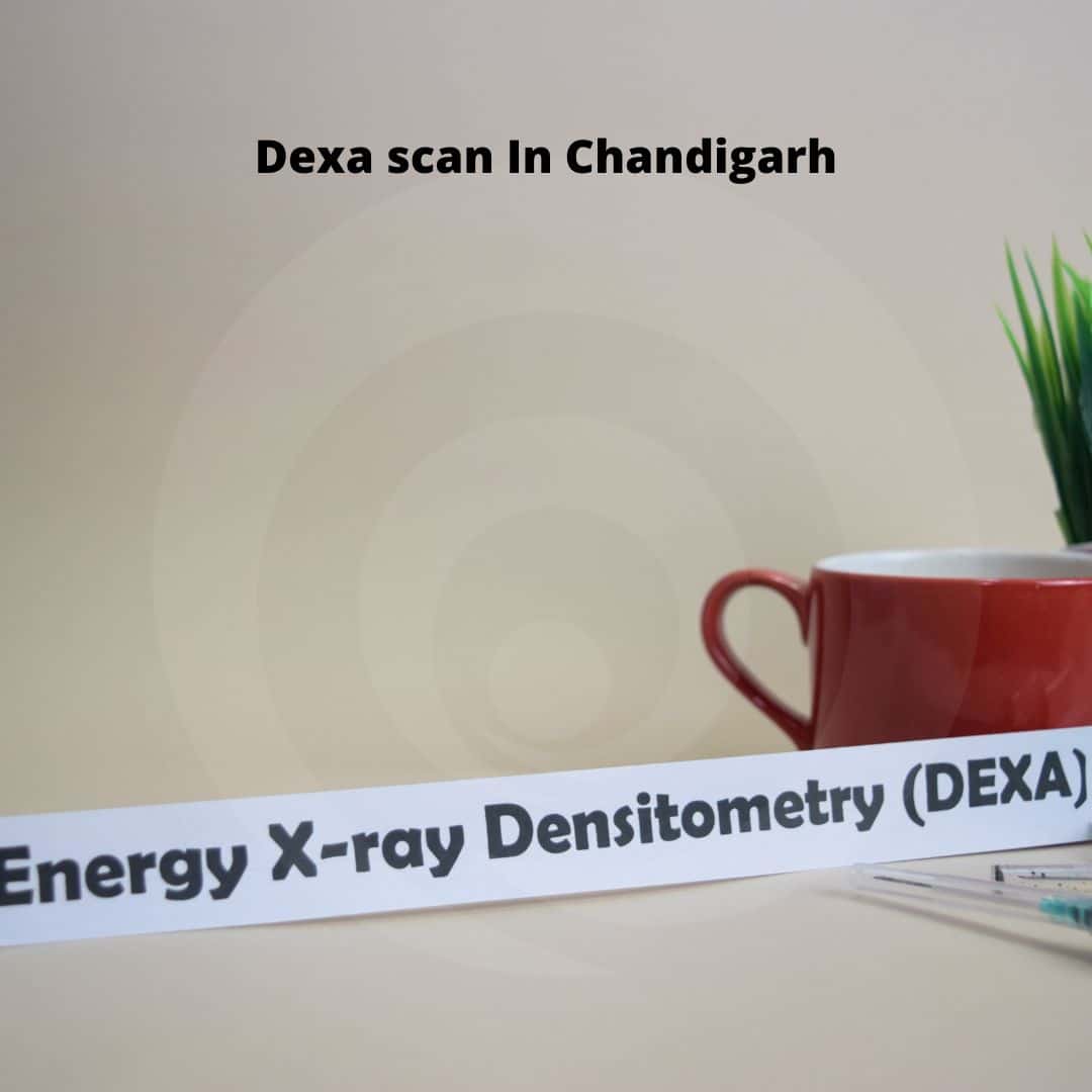 Dexa scan In Chandigarh
