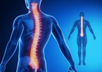 Contrast Mri Whole Spine in Chandigarh