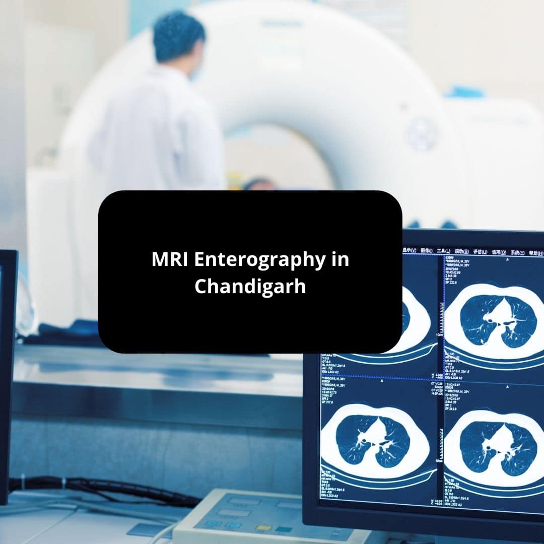 MRI Enterography in Chandigarh