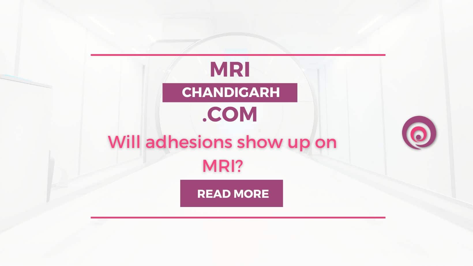 Will adhesions show up on MRI?