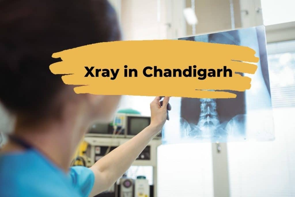 Xray in Chandigarh