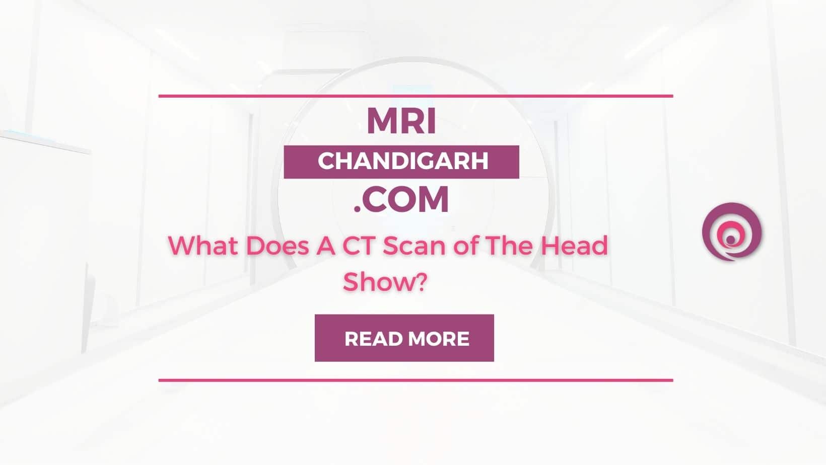 What Does A CT Scan of The Head Show? 