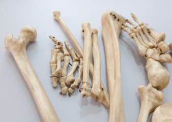 Bone Scan in Chandigarh