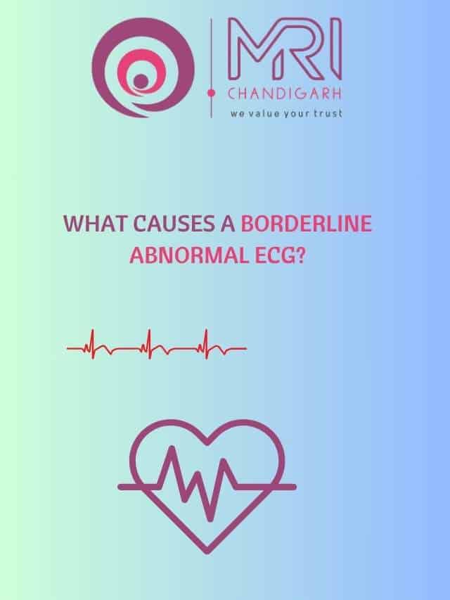 News MRI Chandigarh