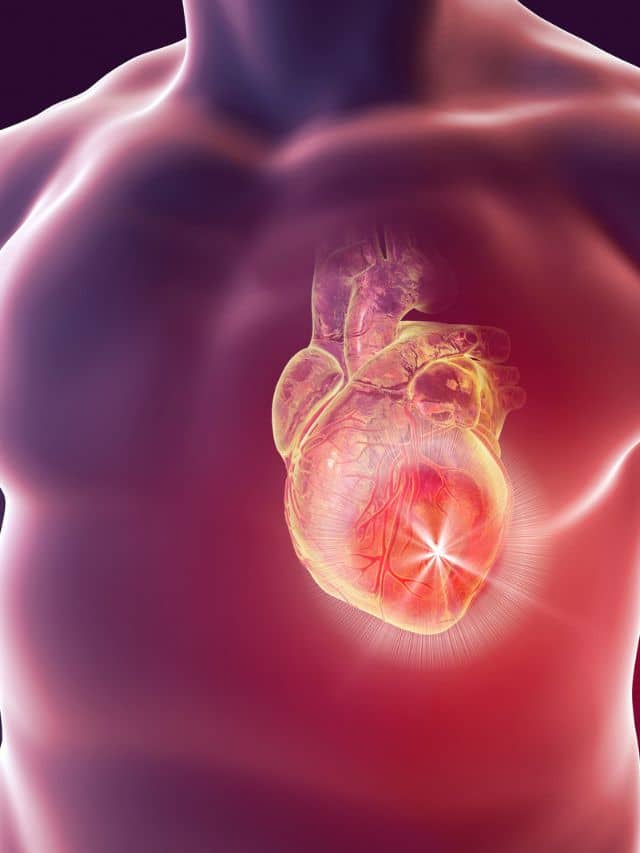FDG Cardiac PET Scan In Chandigarh