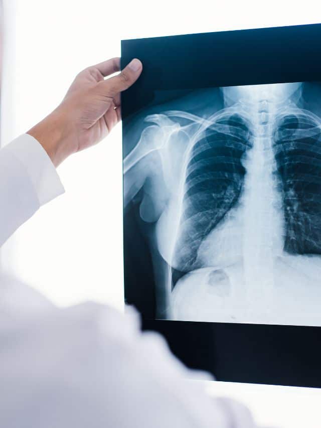 Digital X-Ray in Chandigarh