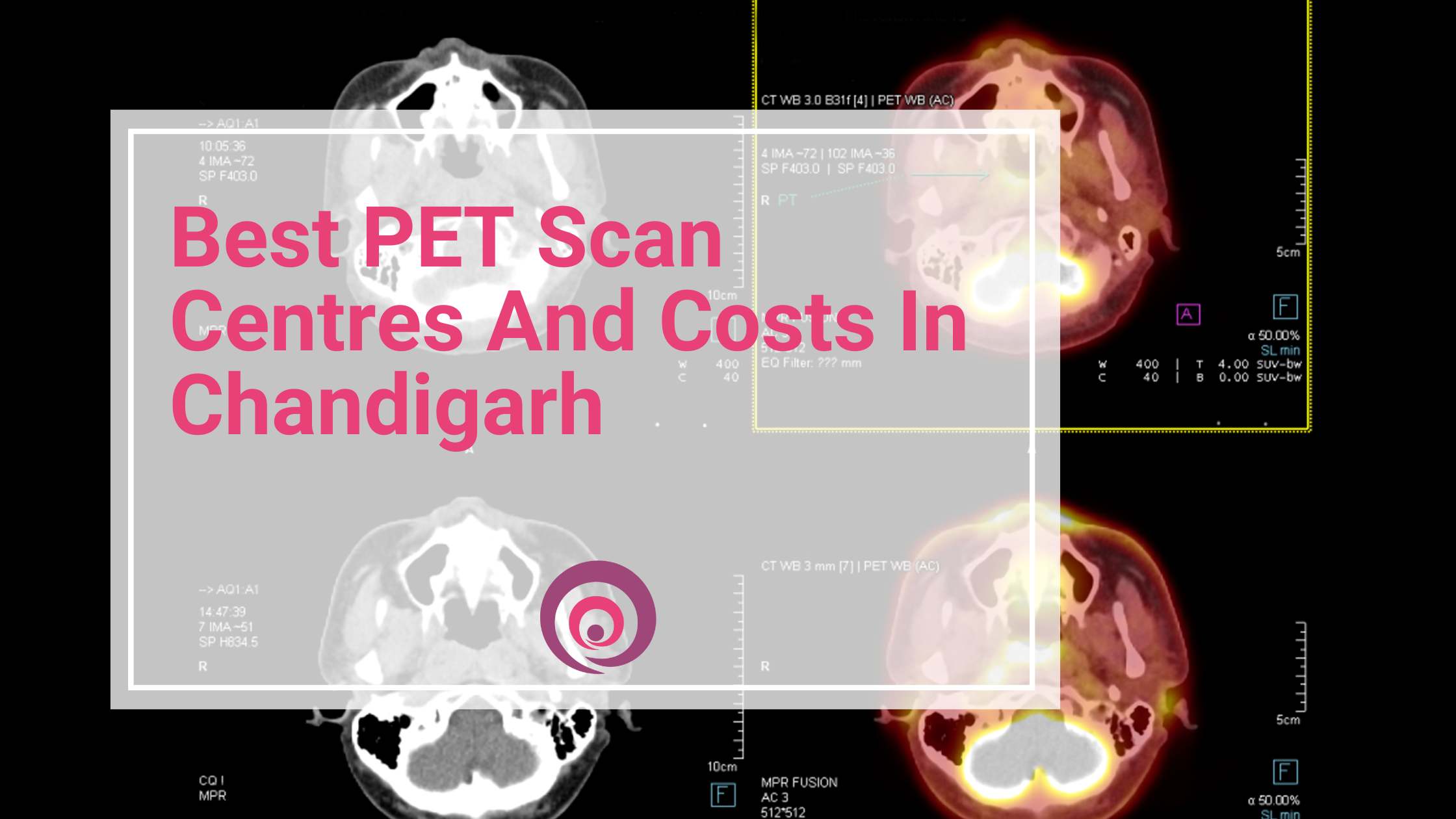 Best PET Scan Centres And Costs In Chandigarh