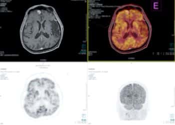 Best PET Scan Centres And Costs In Chandigarh faq