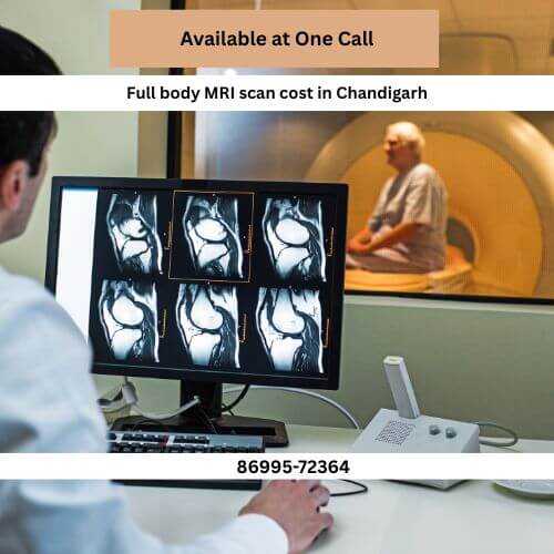 Full body MRI scan cost in Chandigarh