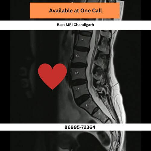 Where to get MRI spine in chd