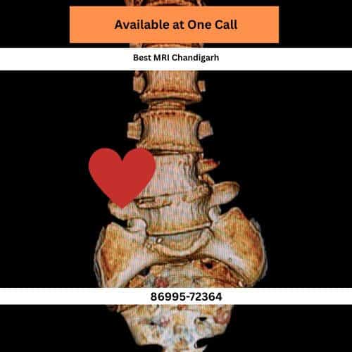 sector 12 best 3t mri in chandigarh