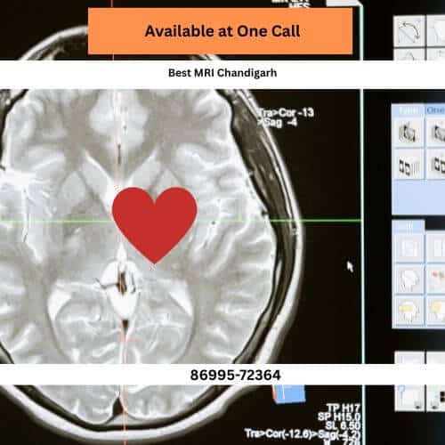 sector 13 best 3t mri in chandigarh