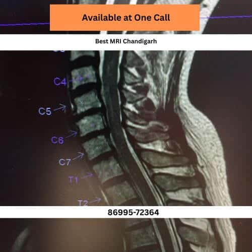 sector 15 best 3t mri in chandigarh