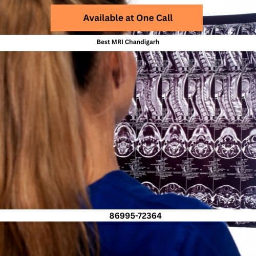 sector 17 best 3t mri in chandigarh