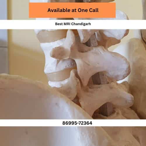 sector 26 best 3t mri in chandigarh