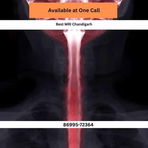 sector 27 best 3t mri in chandigarh