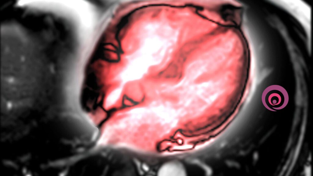 3T MRI NABL certified price Chandigarh