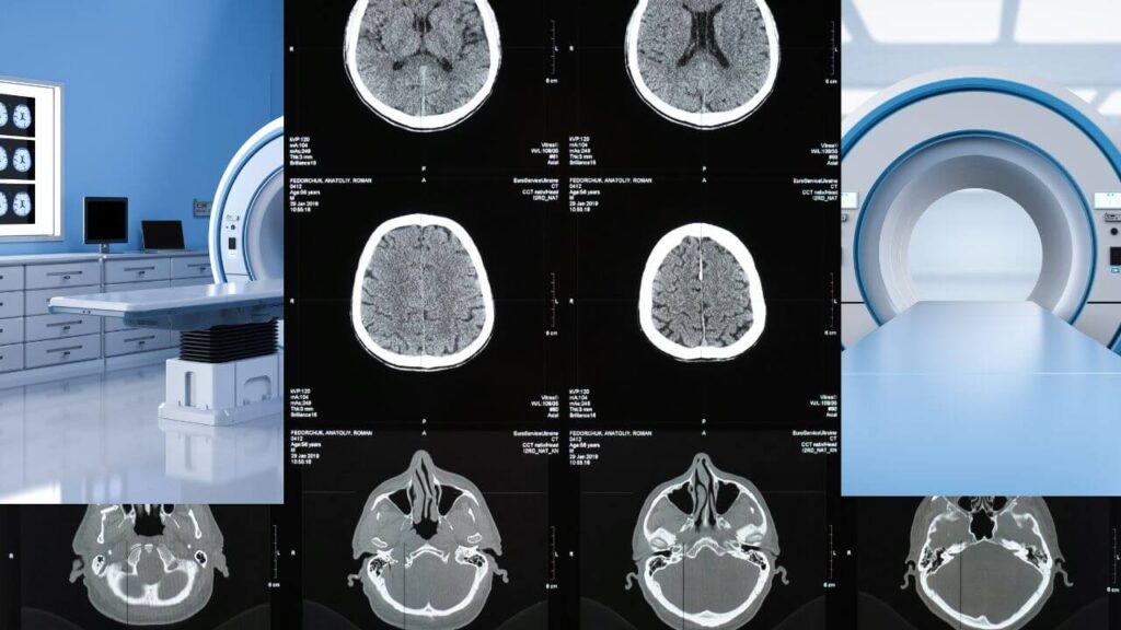 3T MRI diagnostic capabilities
