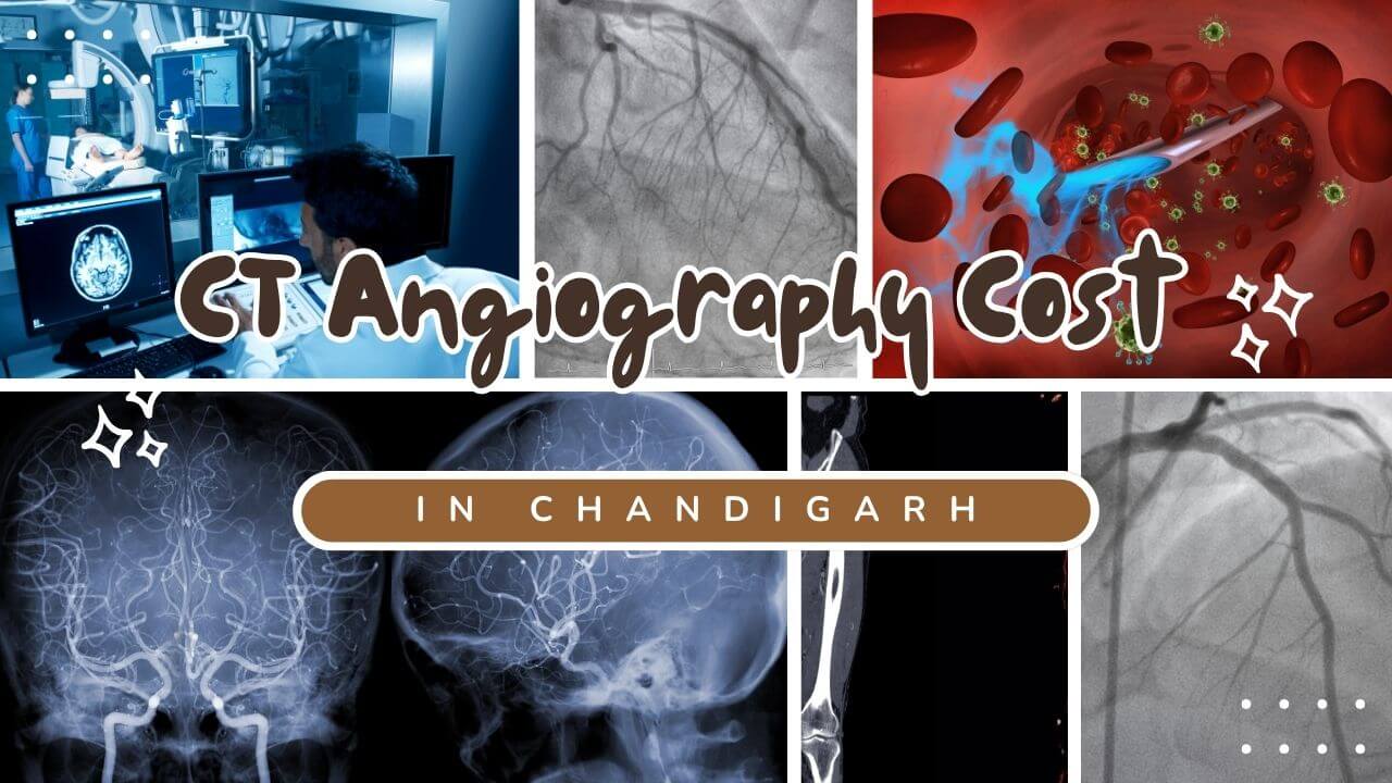 CT Angiography Cost In Chandigarh