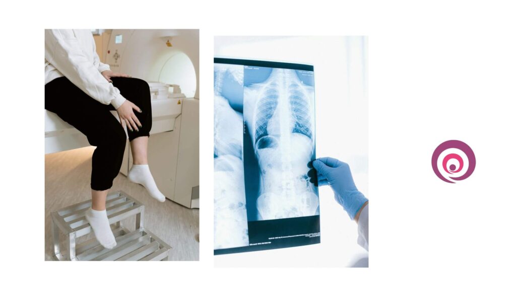 MRI scan charges in Chandigarh NABL approved