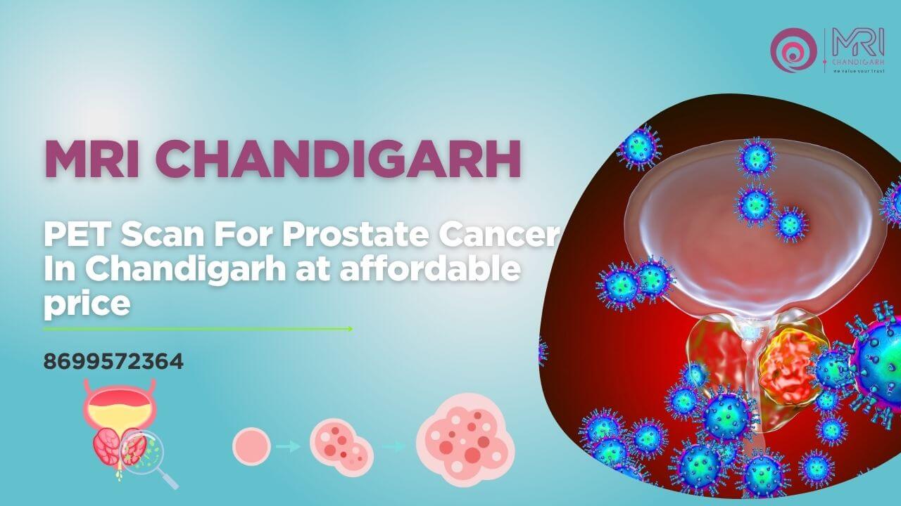 PET Scan For Prostate Cancer In Chandigarh at affordable price