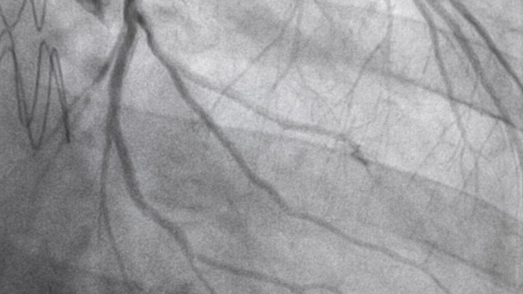 ct angiography price in chandigarh