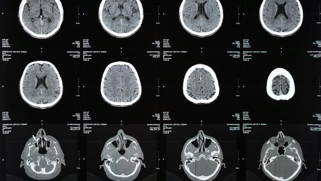 ct scan price in chandigarh