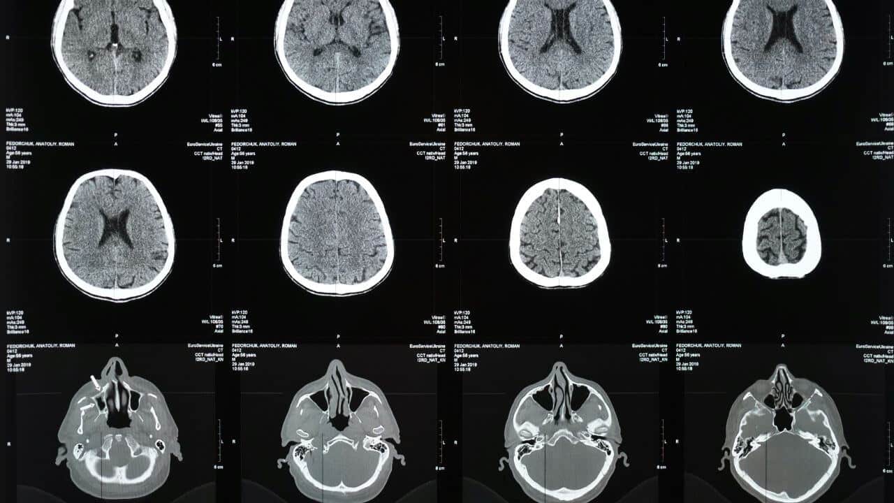 CT Scan in Chandigarh – Cost, Best Centres, and 24×7 Availability