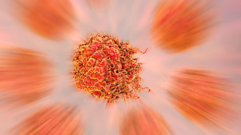 psma pet scan cost in chandigarh 8699572364