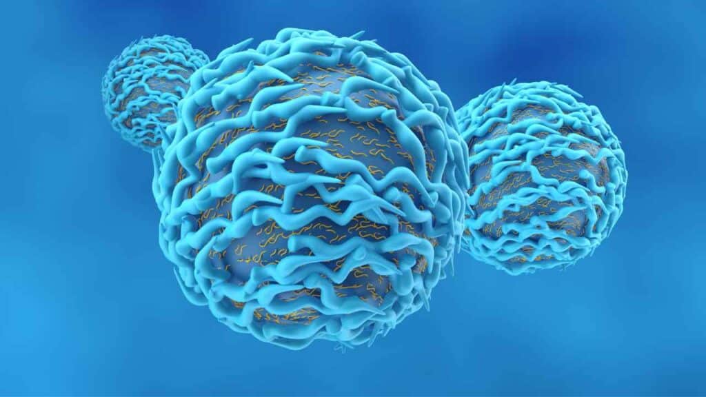 Myeloma FDG avidity - 8699572364