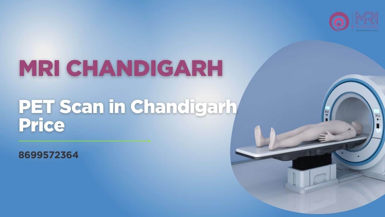 PET Scan in Chandigarh Price
