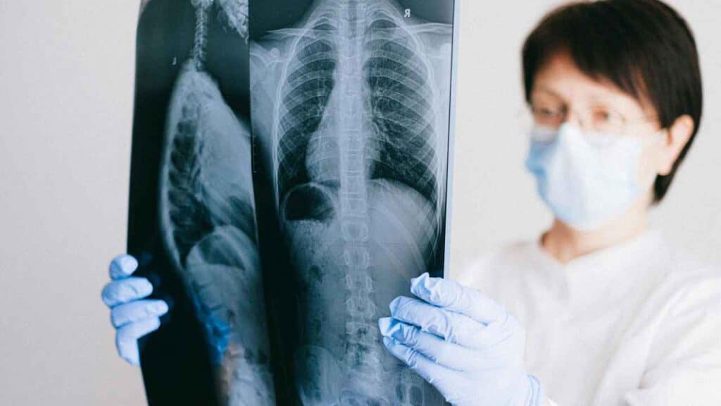 PET scan for cancer-8699572364