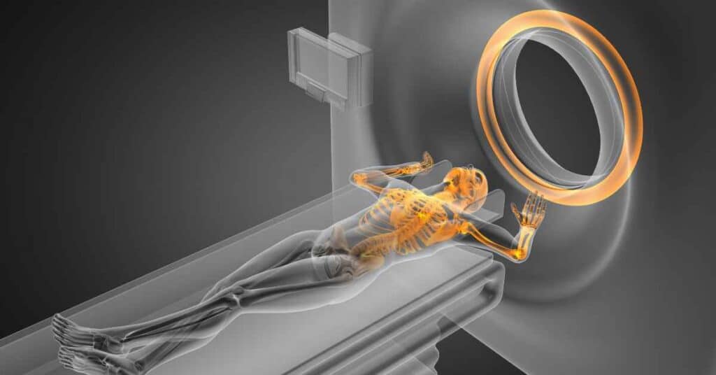 Full body MRI scan in Chandigarh - 86995 72364