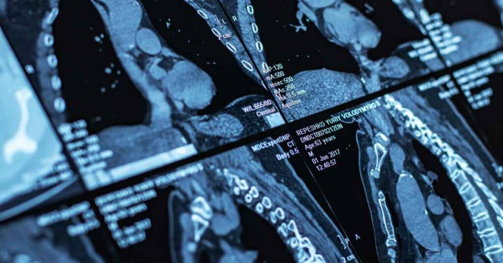 best pet ct scan centre in chandigarh - 8699572364