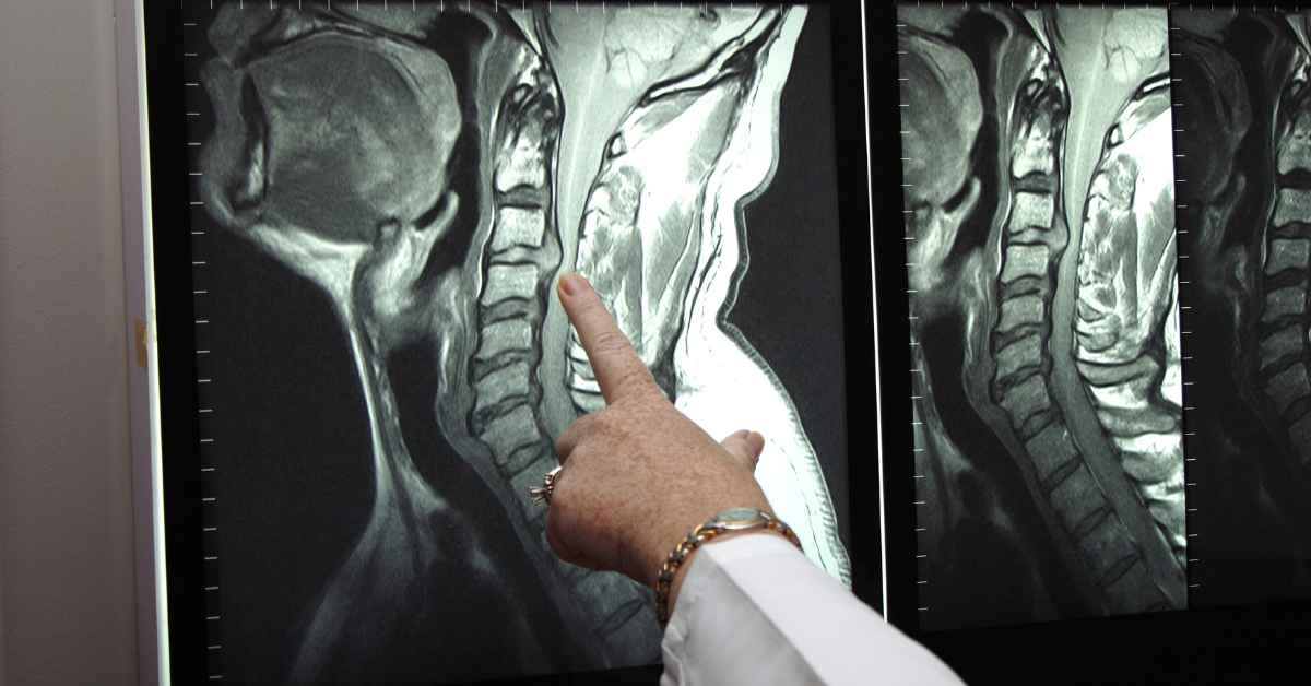 Advanced MRI And CT Scan Centre, Chandigarh