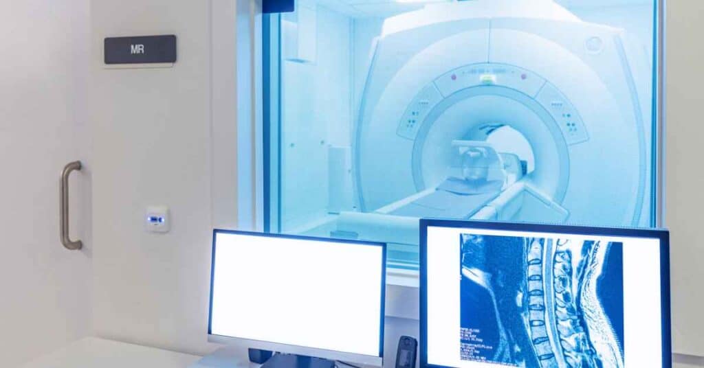 full body mri scan in chandigarh - 8699572364