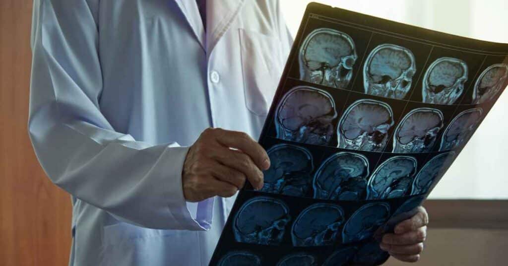 top rated best mri scan near me - 86995-72364