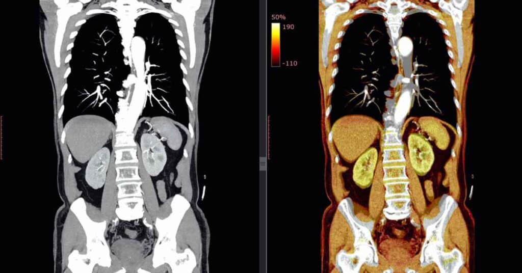 whole body pet scan cost in chandigarh - 8699572364