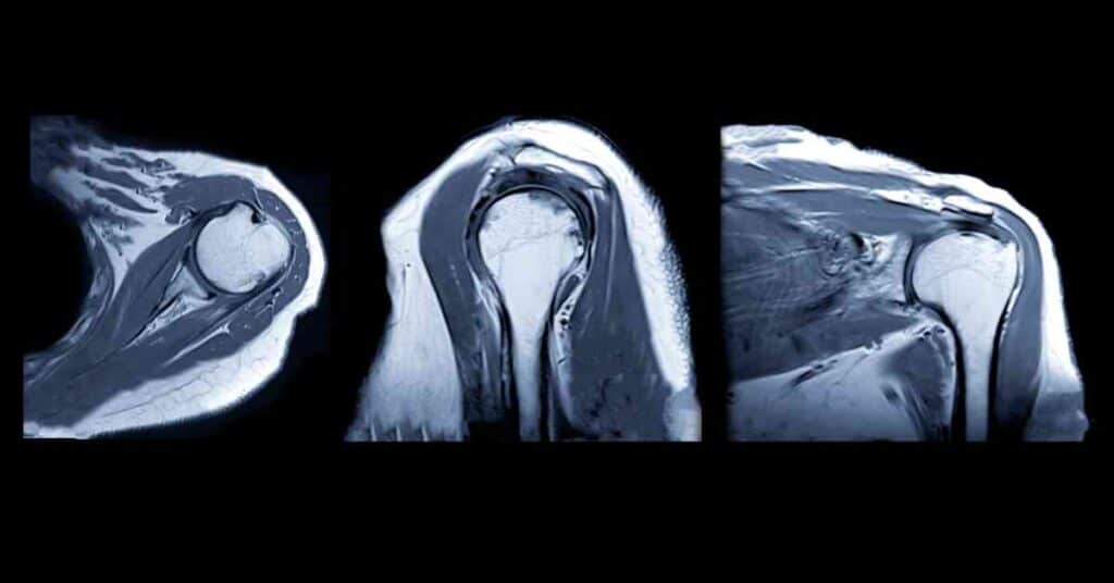 best mri centre in chandigarh - 86995 72364