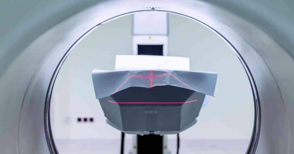 best mri scan centre in chandigarh - 8699572364