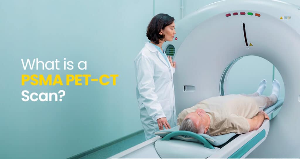 affordable psma pet scan in chandigarh