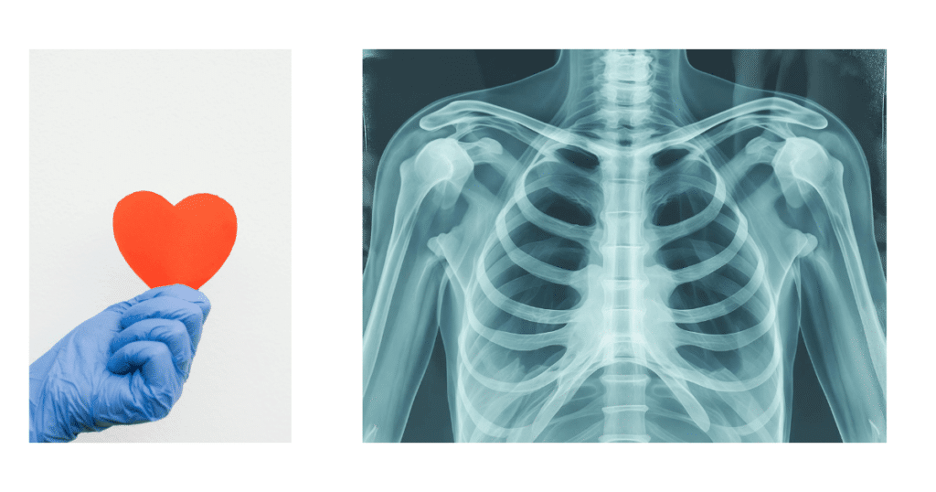 heart scan chandigarh mohali panchkula