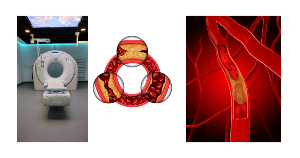 heart vessel imaging test