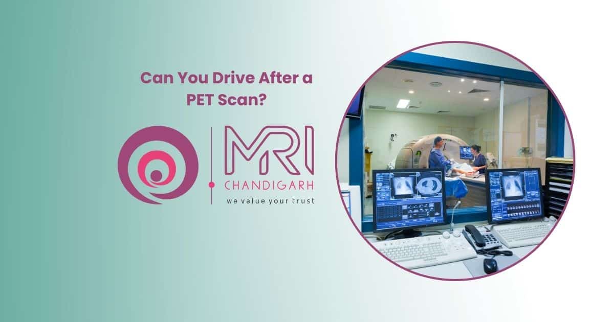 Can You Drive After a PET Scan?